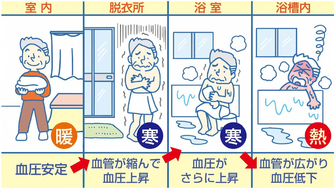 入浴時の事故が多くなる原因の一つは急な温度差による血圧の急激な変化です。ヒートショックになるまでの流れをイラストにまとめたもの。暖房のきいた暖かい部屋から、冷え込んだ脱衣所に移動して衣服を脱ぎ、浴室も寒いと血管が縮まり血圧が一気に上昇します。その後、浴槽に入り体が温まってくると血管が広がり、急上昇した血圧が下がります。この急激な血圧の変化により、一時的に脳内に血液が回らない貧血の状態になり一過性の意識障害を起こすことがあります。